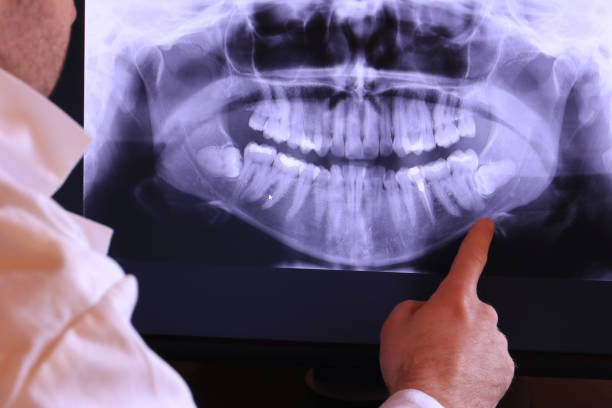 Best Broken Tooth Emergency  in Tiffin, OH
