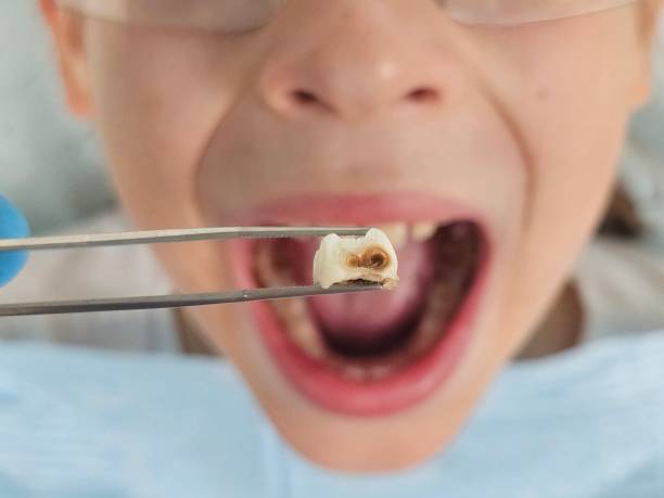 Best Emergency Tooth Extraction  in Tiffin, OH